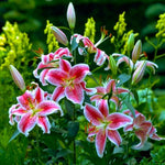 Set 3 Large Pink Lily Bulbs, 4-6 Inch, Pink Lilies Bulbs, Flowering Bulb for Outdoor Garden Beds and Containers